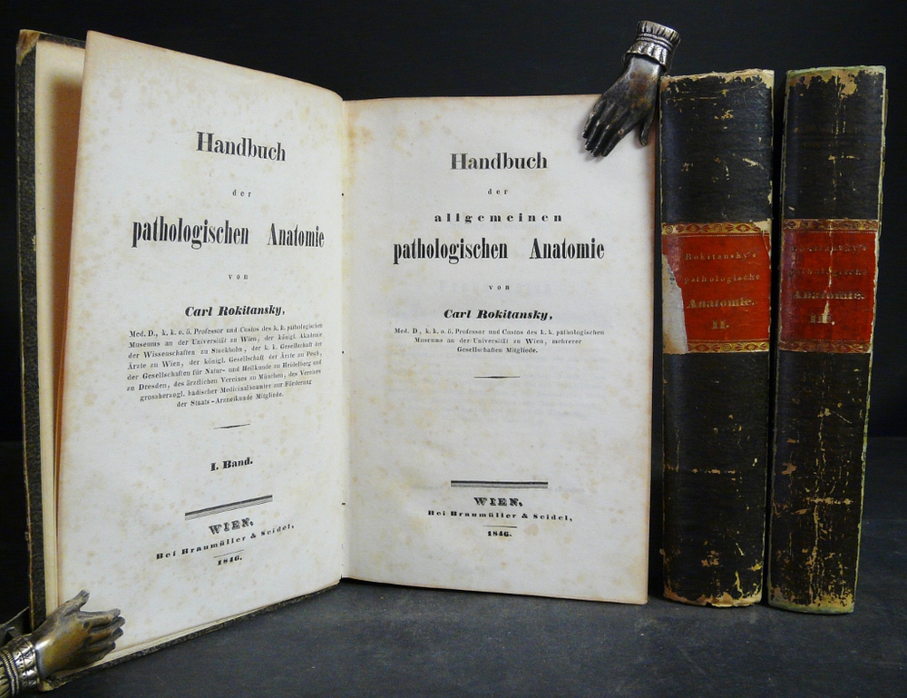 CARL ROKITANSKY Handbuch der pathologischen Anatomie I-III